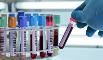 جامعة مدينة السادات تنظم قافله طبية لفيروس سي بقرية كفر داود مركز السادات